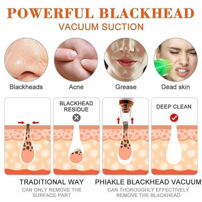Remove Blackhead Device